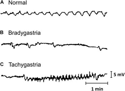 Strategies to Refine Gastric Stimulation and Pacing Protocols: Experimental and Modeling Approaches